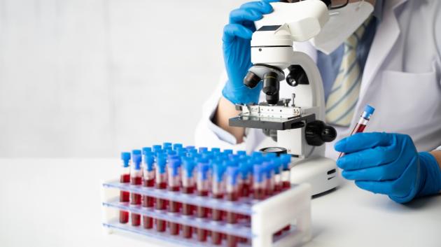 Εξέταση αίματος εργαστήριο