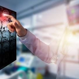 Απεικόνιση εγκεφαλικού επεισοδίου